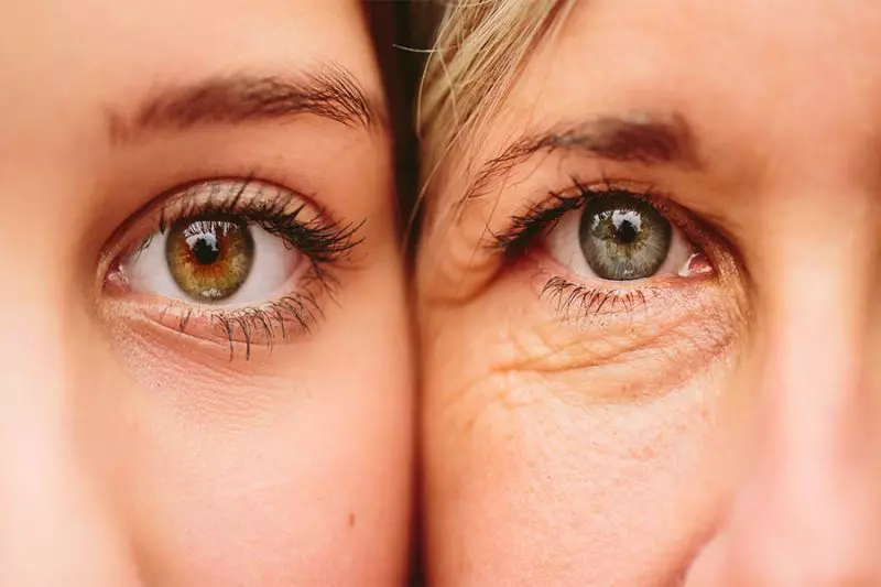 راهکارهای معجزه آسای طبیعی برای رفع چین و چروک های صورت