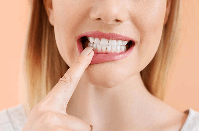 7 روش خانگی موثر برای جرمگیری و سفید کردن دندان ها