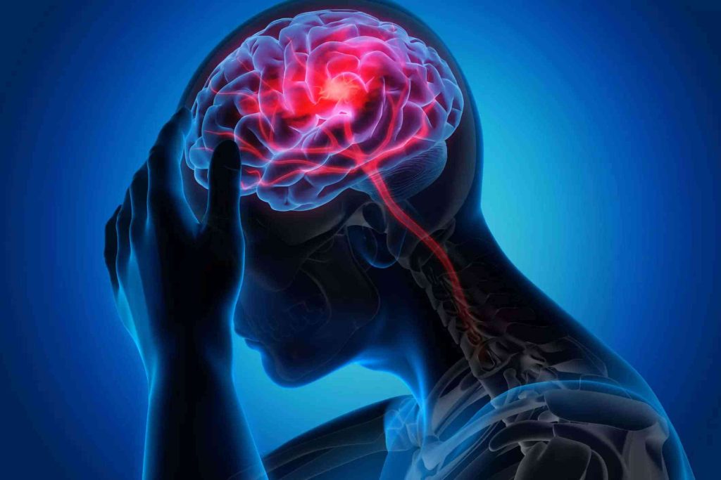 مهم ترین علائم هشداردهنده سکته مغزی