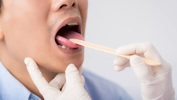 علت سوزش زبان چیست و چه زمانی باید به پزشک مراجعه کرد؟